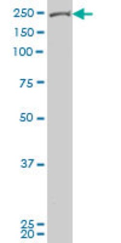 TEK, Mouse anti-Human, Clone: 4G10, Abnova 100 &mu;g | Buy Online | Abnova | Fisher Scientific