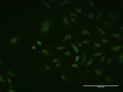 TFAP2A, Mouse anti-Human, Clone: 3E6, Abnova 100&mu;g; Unconjugated:Antibodies,
