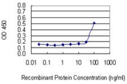 TFDP2, Mouse anti-Human, Clone: 2E6, Abnova 100&mu;g; Unconjugated:Antibodies,