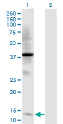 TFF2, Rabbit anti-Human, Polyclonal Antibody, Abnova 100&mu;g; Unconjugated:Antibodies,