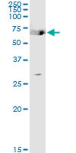 TGM2, Rabbit anti-Human, Polyclonal Antibody, Abnova 100&mu;L; Unconjugated:Antibodies,