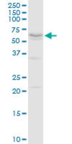 THRA, Rabbit anti-Human, Polyclonal Antibody, Abnova 100&mu;g; Unconjugated:Antibodies,