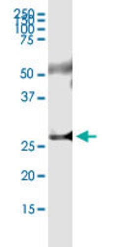 TIA1, Rabbit anti-Human, Polyclonal Antibody, Abnova 100&mu;L; Unconjugated:Antibodies,