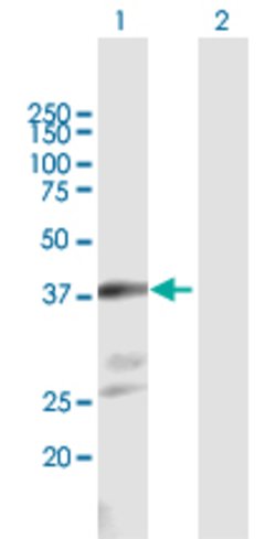 NKX2-1, Mouse anti-Human, Polyclonal Antibody, Abnova 50&mu;g; Unconjugated:Antibodies,