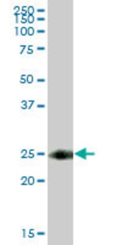 TSPAN8, Mouse anti-Human, Polyclonal Antibody, Abnova 50&mu;g; Unconjugated:Antibodies,