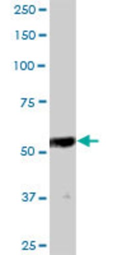 TMPO, Mouse anti-Human, Polyclonal Antibody, Abnova 50&mu;g; Unconjugated:Antibodies,