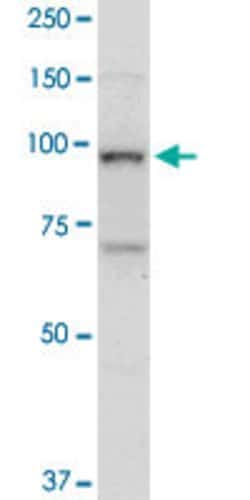 TOP1, Mouse anti-Human, Clone: 1A1, Abnova 100&mu;g; Unconjugated:Antibodies,