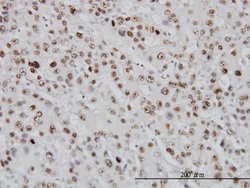 TOP1, Mouse anti-Human, Clone: 1A1, Abnova 100&mu;g; Unconjugated:Antibodies,
