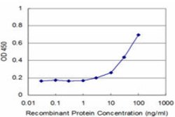 TPM2, Mouse anti-Human, Clone: 3C8, Abnova 100&mu;g; Unconjugated:Antibodies,