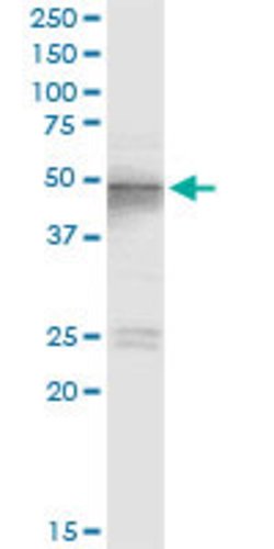 TSG101, Rabbit anti-Human, Polyclonal Antibody, Abnova 100&mu;L; Unconjugated:Antibodies,