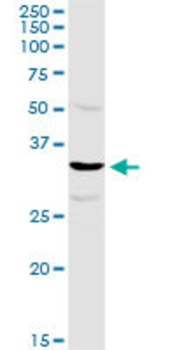 TTC1, Rabbit anti-Human, Polyclonal Antibody, Abnova 100&mu;L; Unconjugated:Antibodies,