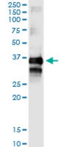 TTC1, Rabbit anti-Human, Polyclonal Antibody, Abnova 100&mu;L; Unconjugated:Antibodies,