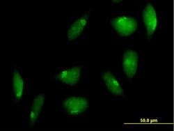TTK, Mouse anti-Human, Polyclonal Antibody, Abnova 50&mu;g; Unconjugated:Anticuerpos