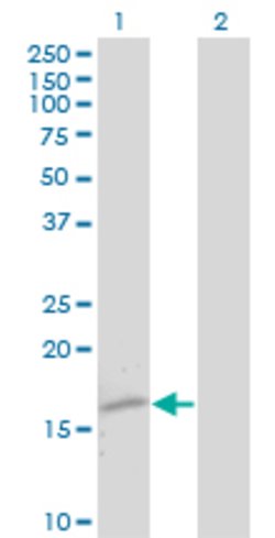 TTR, Mouse anti-Human, Clone: 4D8, Abnova 100 &mu;g | Buy Online | Abnova | Fisher Scientific