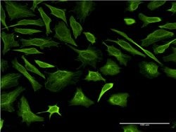 TUBB2A, Mouse anti-Human, Clone: 2B2, Abnova 100 &mu;g | Buy Online | Abnova | Fisher Scientific