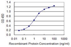 UPK1B, Mouse anti-Human, Clone: 4F4, Abnova 100 &mu;g | Buy Online | Abnova | Fisher Scientific
