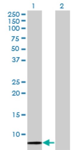 SCGB1A1, Mouse anti-Human, Clone: 1F7, Abnova 100 &mu;g | Buy Online | Abnova | Fisher Scientific