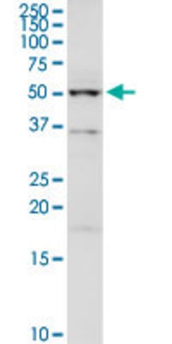 UGP2, Rabbit anti-Human, Polyclonal Antibody, Abnova 100&mu;g; Unconjugated:Antibodies,