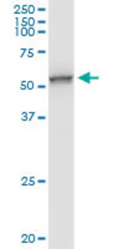 UGP2, Rabbit anti-Human, Polyclonal Antibody, Abnova 100&mu;g; Unconjugated:Antibodies,