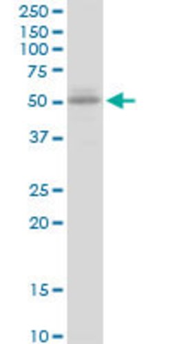 UGT2B15, Mouse anti-Human, Polyclonal Antibody, Abnova 50&mu;g; Unconjugated:Antibodies,