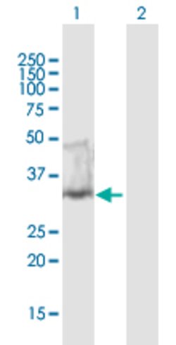 UNG, Mouse anti-Human, Polyclonal Antibody, Abnova 50 &mu;g | Buy Online | Abnova | Fisher Scientific
