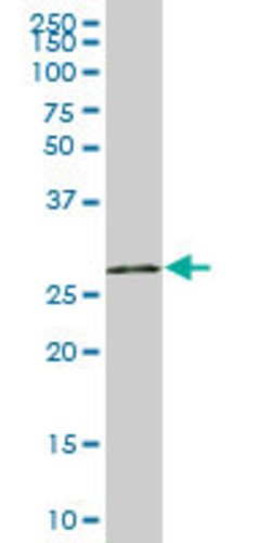 UNG, Mouse anti-Human, Polyclonal Antibody, Abnova 50 &mu;g | Buy Online | Abnova | Fisher Scientific