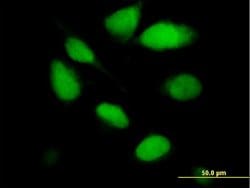 UNG, Mouse anti-Human, Polyclonal Antibody, Abnova 50 &mu;g | Buy Online | Abnova | Fisher Scientific