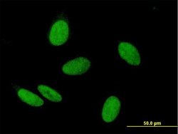WHSC2, Mouse anti-Human, Polyclonal Antibody, Abnova 50&mu;g; Unconjugated:Antibodies,