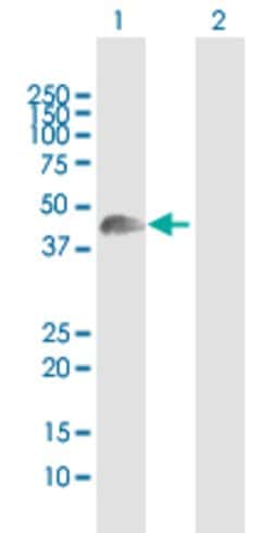 WNT8A, Rabbit anti-Human, Polyclonal Antibody, Abnova 100&mu;L; Unconjugated:Antibodies,