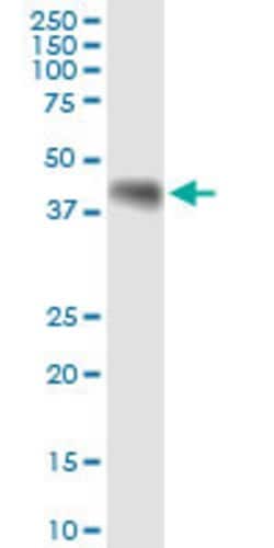 WNT8A, Rabbit anti-Human, Polyclonal Antibody, Abnova 100&mu;L; Unconjugated:Antibodies,