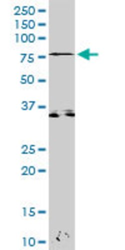 ZAP70, Rabbit anti-Human, Polyclonal Antibody, Abnova 100&mu;g; Unconjugated:Anticuerpos