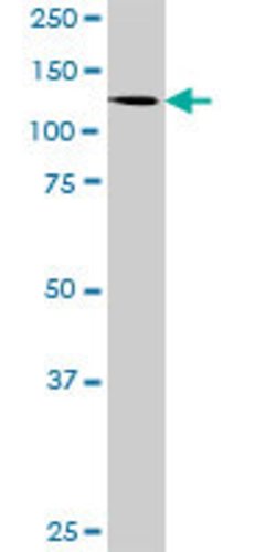 ZSCAN20, Rabbit anti-Human, Polyclonal Antibody, Abnova 100&mu;L; Unconjugated:Antibodies,