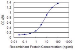 ZSCAN21, Mouse anti-Human, Clone: 4B11, Abnova 100 &mu;g | Buy Online | Abnova | Fisher Scientific
