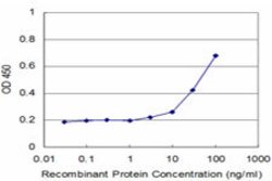 ZNF70, Mouse anti-Human, Clone: 1D8, Abnova 100&mu;g; Unconjugated:Antibodies,