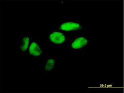 ZNF187, Mouse anti-Human, Polyclonal Antibody, Abnova 50&mu;g; Unconjugated:Antibodies,