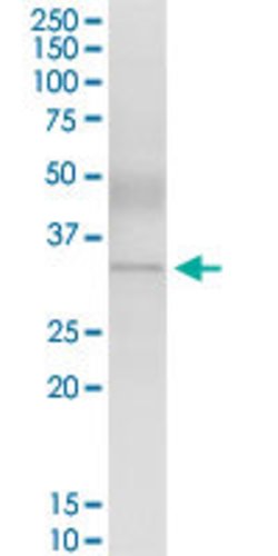 ZNF215, Rabbit anti-Human, Polyclonal Antibody, Abnova 100&mu;L; Unconjugated:Antibodies,