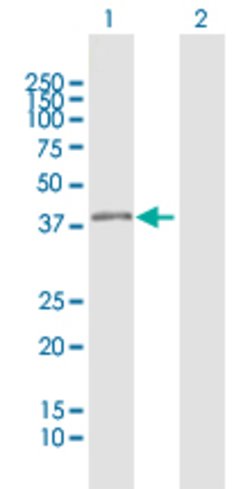 BSND, Rabbit anti-Human, Polyclonal Antibody, Abnova 100&mu;L; Unconjugated:Antibodies,