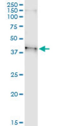 BSND, Rabbit anti-Human, Polyclonal Antibody, Abnova 100&mu;L; Unconjugated:Antibodies,