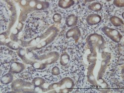 STAM, Mouse anti-Human, Clone: 2B11-1G1, Abnova 100 &mu;g | Buy Online | Abnova | Fisher Scientific