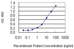 STAM, Mouse anti-Human, Clone: 2B11-1G1, Abnova 100 &mu;g | Buy Online | Abnova | Fisher Scientific