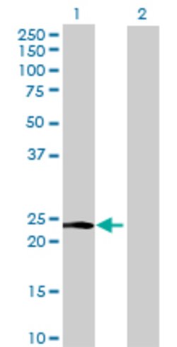 MFAP5, Mouse anti-Human, Polyclonal Antibody, Abnova 50&mu;L; Unconjugated:Antibodies,