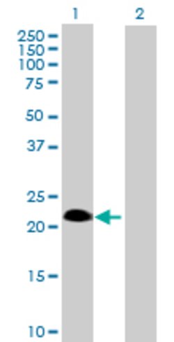 SSPN, Mouse anti-Human, Polyclonal Antibody, Abnova 50&mu;g; Unconjugated:Antibodies,