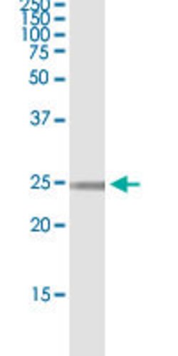 SSPN, Rabbit anti-Human, Polyclonal Antibody, Abnova 100&mu;L; Unconjugated:Antibodies,