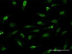 HMGA2, Mouse anti-Human, Clone: 2D3, Abnova 100&mu;g; Unconjugated:Antibodies,
