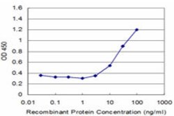 ALX1, Mouse anti-Human, Clone: 2A10, Abnova 100 &mu;g | Buy Online | Abnova | Fisher Scientific