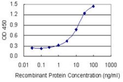 HDHD1A, Mouse anti-Human, Clone: 4F12, Abnova 100 &mu;g | Buy Online | Abnova | Fisher Scientific