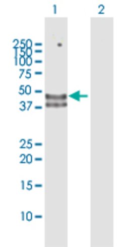 HYAL3, Rabbit anti-Human, Polyclonal Antibody, Abnova 100 &mu;L | Buy Online | Abnova | Fisher Scientific