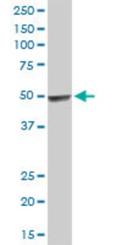 HYAL3, Rabbit anti-Human, Polyclonal Antibody, Abnova 100 &mu;L | Buy Online | Abnova | Fisher Scientific
