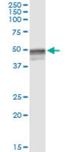 HYAL3, Rabbit anti-Human, Polyclonal Antibody, Abnova 100 &mu;L | Buy Online | Abnova | Fisher Scientific