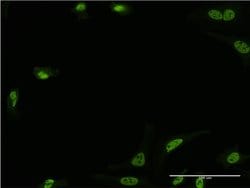 STK24, Mouse anti-Human, Clone: 4G5, Abnova 100&mu;g; Unconjugated:Antibodies,